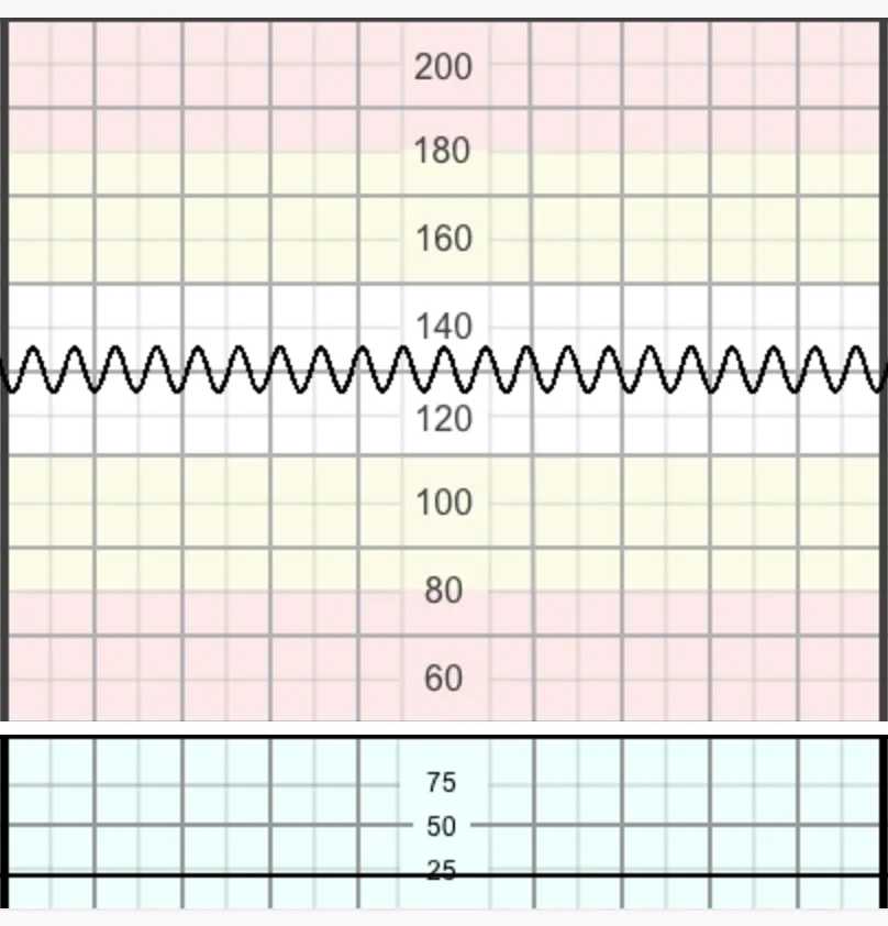 Kiểu hình sin (Sinusoidal)